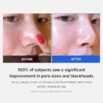 Medicube zero pore pad 2.0 70 disques_2