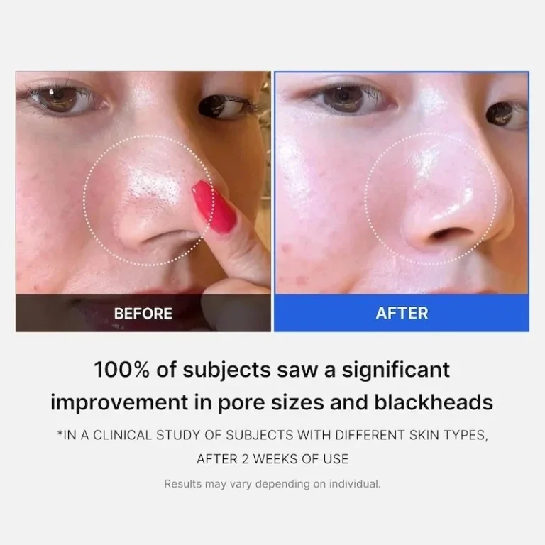 Medicube zero pore pad 2.0 70 disques_2